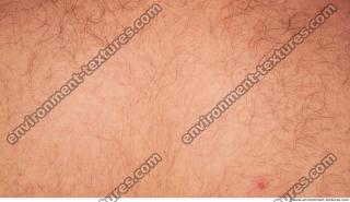 hairy skin white 0001